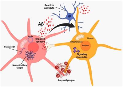 Alzheimer’s disease: a review on the current trends of the effective diagnosis and therapeutics